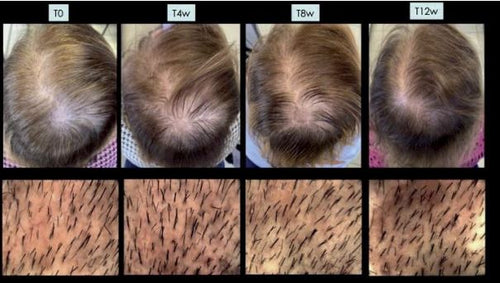 Anti-Hair Loss Routine